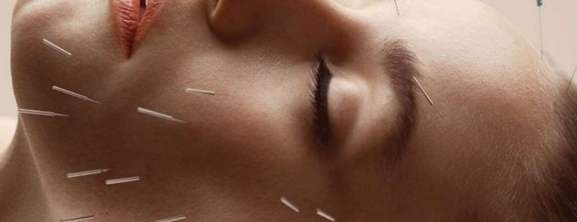 Acupuncture for Face